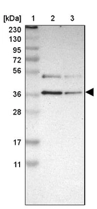 Lane 1: Marker [kDa] 230, 130, 95, 72, 56, 36, 28, 17, 11_br/_Lane 2: Human cell line RT-4_br/_Lane 3: Human cell line U-251MG sp