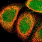 Immunofluorescent staining of human cell line A-431 shows localization to nucleus, plasma membrane & cytosol.