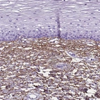 Immunohistochemical staining of human cervix, uterine shows strong positivity in extracellular matrix in squamous epithelial cells.