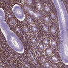 Immunohistochemical staining of human endometrium shows strong positivity in extracellular matrix in cells in endometrial stroma.