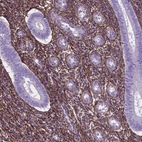 Immunohistochemical staining of human endometrium shows strong positivity in extracellular matrix in cells in endometrial stroma.
