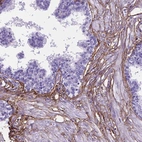 Immunohistochemical staining of human prostate shows moderate positivity in extracellular matrix in smooth muscle cells.