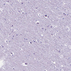 Immunohistochemical staining of human cerebral cortex shows no positivity in neurons as expected.