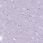 Anti-MFAP2 Antibody