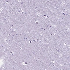 Immunohistochemical staining of human cerebral cortex shows no positivity in neurons as expected.