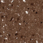 Immunohistochemical staining of human cerebral cortex shows strong cytoplasmic positivity in neurons.