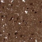 Immunohistochemical staining of human cerebral cortex shows strong cytoplasmic positivity in neurons.