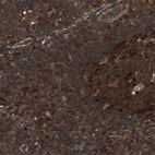 Immunohistochemical staining of human lymph node shows strong cytoplasmic positivity in non-germinal center cells.