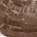 Immunohistochemical staining of human skeletal muscle shows moderate to strong cytoplasmic positivity in myocytes.