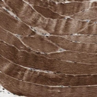 Immunohistochemical staining of human skeletal muscle shows moderate to strong cytoplasmic positivity in myocytes.