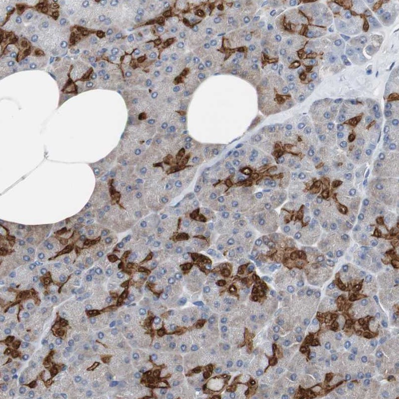 Anti-ANXA4 Antibody