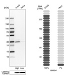 Western blot analysis in human cell lines A-549 and HeLa using Anti-ANXA4 antibody. Corresponding ANXA4 RNA-seq data are presented for the same cell lines. Loading control: Anti-COX4I1.