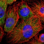 Immunofluorescent staining of human cell line U-251 MG shows localization to cytosol.