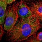Immunofluorescent staining of human cell line U-251 MG shows localization to cytosol.