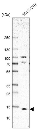 Anti-SMIM8 Antibody