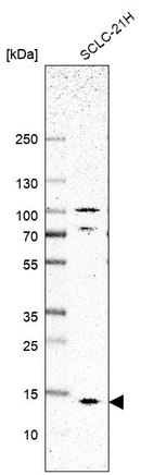 Western blot analysis in human cell line SCLC-21H.