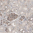 Anti-IL1RL1 Antibody