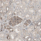 Immunohistochemical staining of human kidney shows moderate membranous positivity in cells in glomeruli.