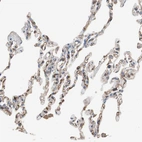 Immunohistochemical staining of human lung shows moderate membranous positivity in pneumocytes.