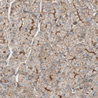 Anti-IL1RL1 Antibody