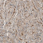 Immunohistochemical staining of human stomach shows moderate membranous positivity in glandular cells.
