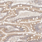 Immunohistochemical staining of human small intestine shows moderate granular cytoplasm positivity in glandular cells.