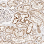 Immunohistochemical staining of human kidney shows moderate granular cytoplasm positvity in cells in tubules.