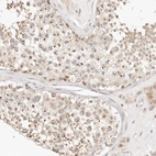 Immunohistochemical staining of human testis shows moderate granular cytoplasm positivity in cells in seminiferous ducts.