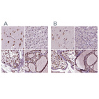 Anti-RCOR3 Antibody