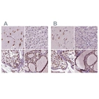 Anti-RCOR3 Antibody