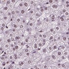Immunohistochemical staining of human liver using Anti-RCOR3 antibody HPA007413.