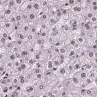 Immunohistochemical staining of human liver using Anti-RCOR3 antibody HPA007413.