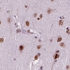 Immunohistochemical staining of human cerebral cortex using Anti-RCOR3 antibody HPA007413.