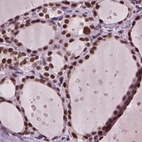 Immunohistochemical staining of human thyroid gland using Anti-RCOR3 antibody HPA007413.