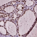 Immunohistochemical staining of human thyroid gland using Anti-RCOR3 antibody HPA007413.