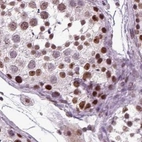 Immunohistochemical staining of human testis using Anti-RCOR3 antibody HPA007413.