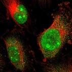 Immunofluorescent staining of human cell line U-251 MG shows localization to nucleus, nucleoli & cytosol.