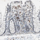 Immunohistochemical staining of human colon shows moderate to strong nuclear positivity in a subset of lymphoid cells.