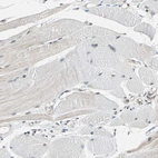 Immunohistochemical staining of human skeletal muscle shows weak positivity in myocytes.