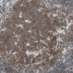 Immunohistochemical staining of human tonsil shows positivity in germinal center cells.