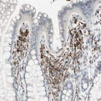 Immunohistochemical staining of human colon shows positivity in lymphoid cells.