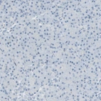 Immunohistochemical staining of human pancreas shows no positivity as expected.