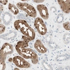 Anti-CDK3 Antibody