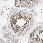 Immunohistochemical staining of human Testis shows strong membranous positivity in cells in seminiferous ducts.
