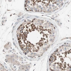 Immunohistochemical staining of human Testis shows strong membranous positivity in cells in seminiferous ducts.