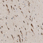 Immunohistochemical staining of human Cerebral cortex shows strong cytoplasmic positivity in neuronal cells.