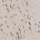 Immunohistochemical staining of human Cerebral cortex shows strong cytoplasmic positivity in neuronal cells.