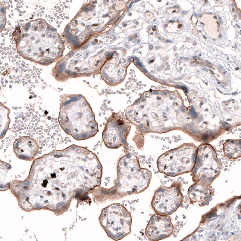 Anti-TSPAN13 Antibody