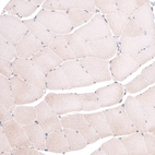 Immunohistochemical staining of human skeletal muscle shows no membranous positivity in striated muscle fibers as expected.