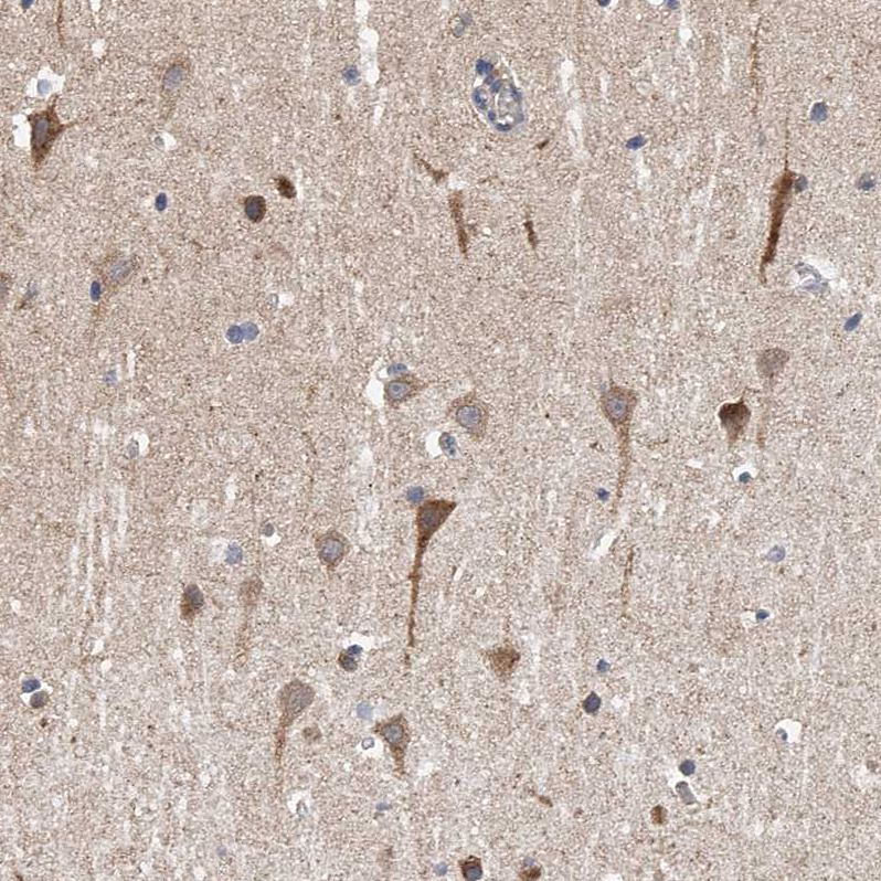 Anti-SPOCK1 Antibody